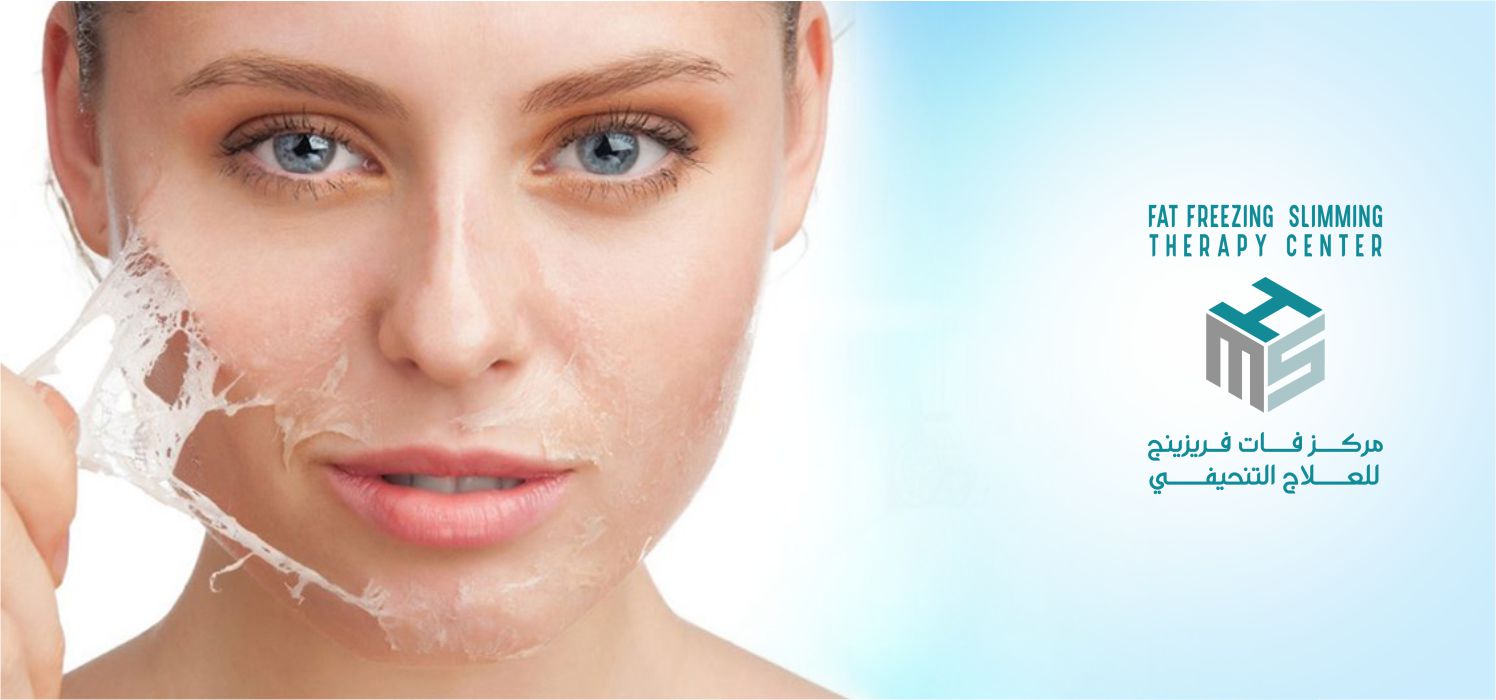 Chemical Peel