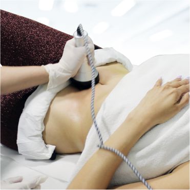 Cavitation