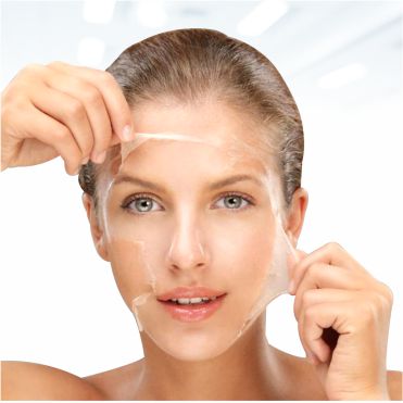 Chemical Peel