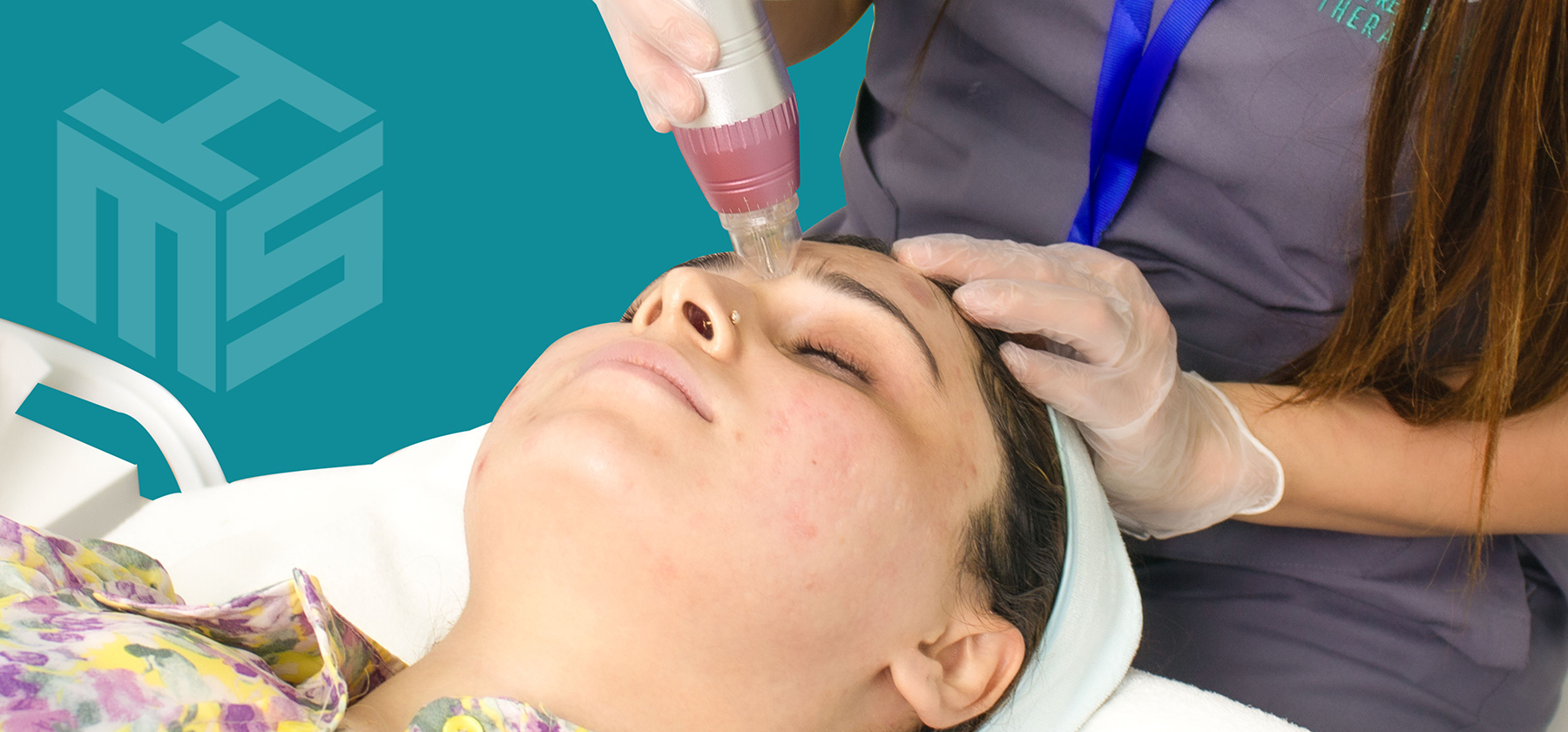 RF Microneedling