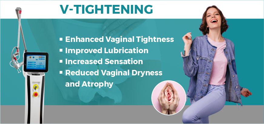 V tightening