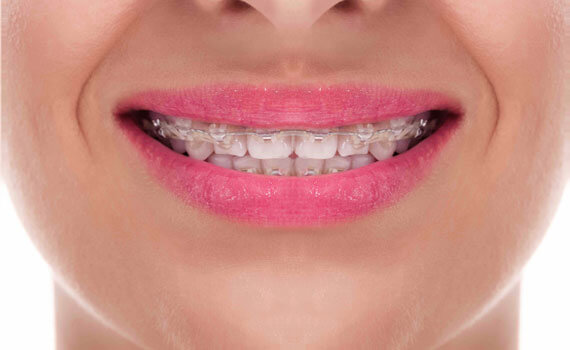 smile 1 1