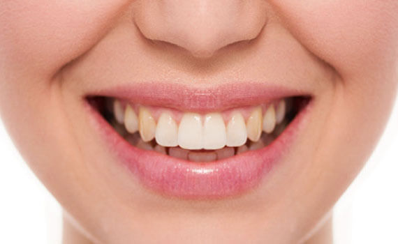 smile 2 1