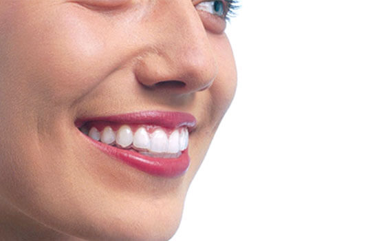 smile 3 2