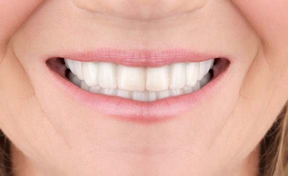 smile 4 2
