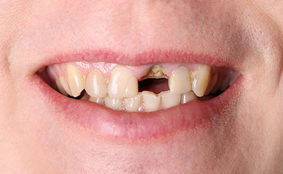 smile 5 1