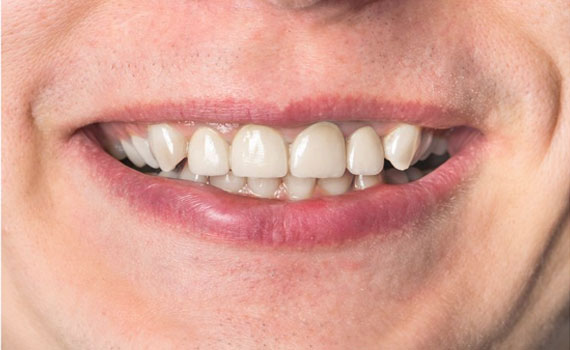 smile 5 2