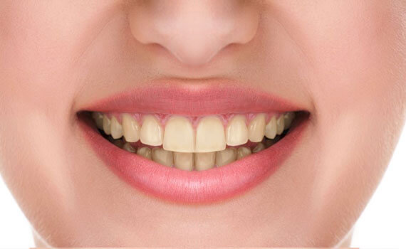 smile 7 1