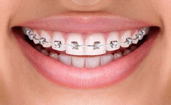 smile 8 1